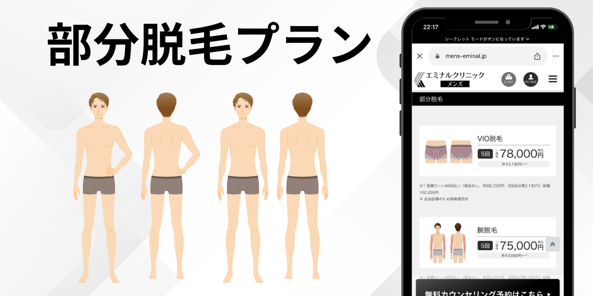 エミナルクリニックメンズ部分脱毛プラン